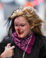 victim policía 18 O barcelona 2