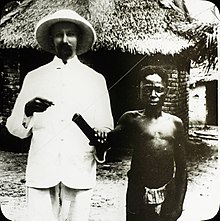 mutilcación congo