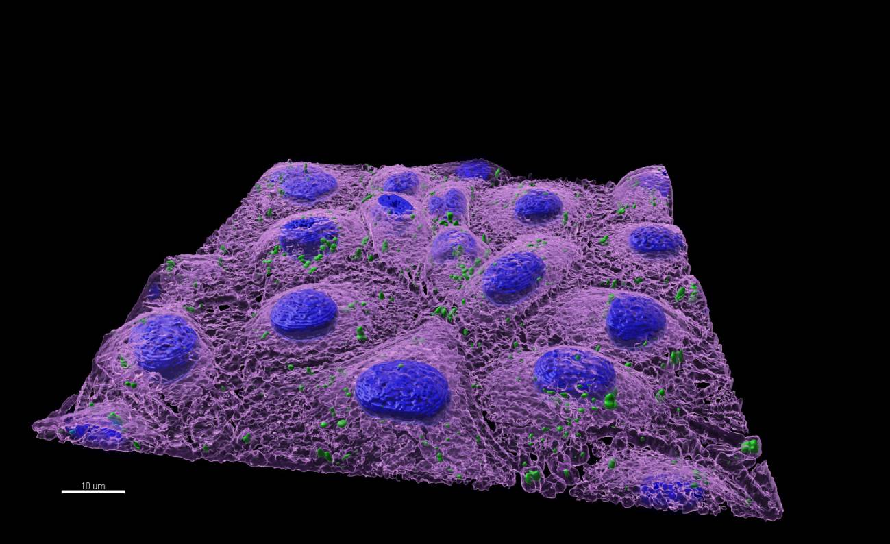 Nanoplásticos (en verde) dentro de una célula de pez cebra.  CREAF