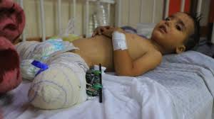 LA VERDAD EN GAZA